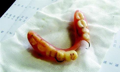 专家提醒！戴假牙的4大禁忌，很多人经常做