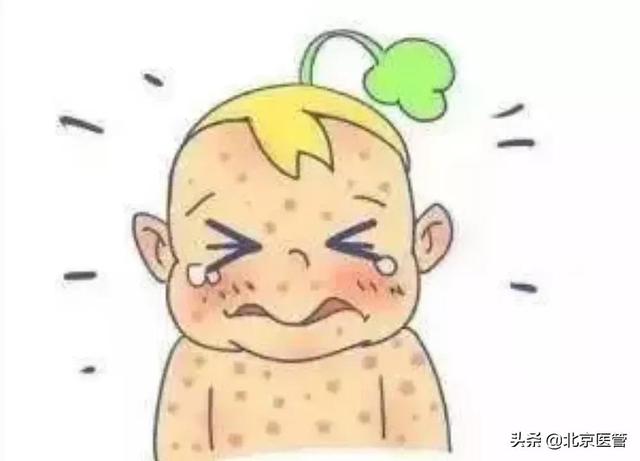 幼儿急疹为什么这么“磨人”？