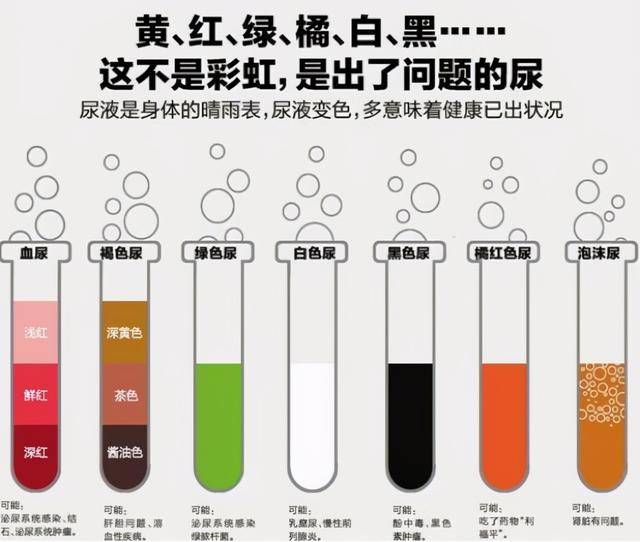 肾好不好一泡尿就能知晓？尿液常有几种变化，需给肾做检查