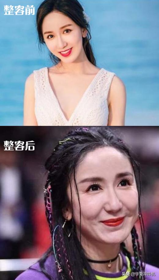 侣皓喆:明星大型“翻车”现场，她们是如何整容变毁容的