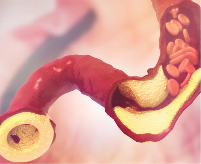 头痛头晕脑缺血3种常见药物，了解适应症禁忌症，治疗脑血管疾病