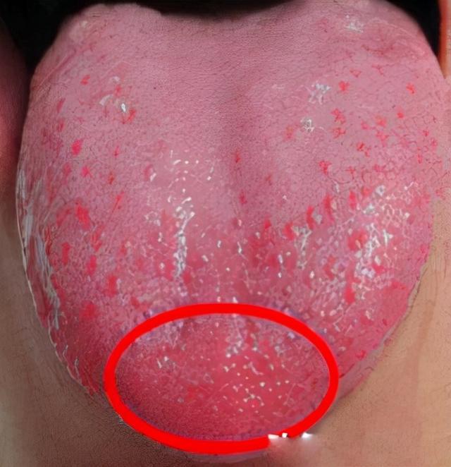 下半身怕寒、脚凉，上半身怕热，爱上火，可能是上热下寒了