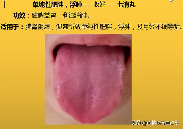 咽炎、高脂血症，四肢麻木，10个中成药，年过35岁后要收藏备好