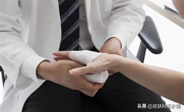 汗疱疹反复性发作，瘙痒难耐，医生教你用3个方法解决，快速有效