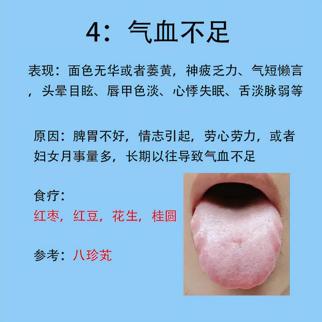 女人常见6种症状，以及对应舌象和解决的方法分享