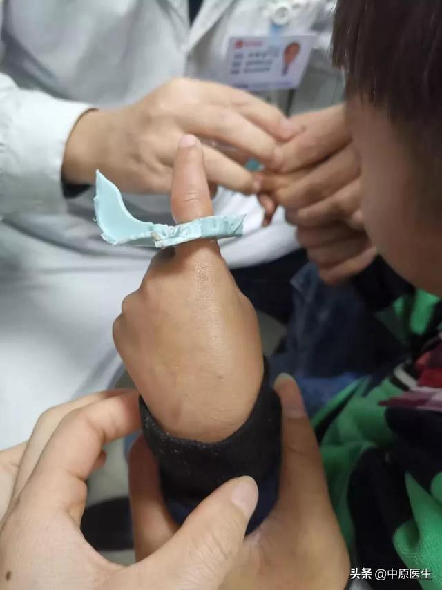 小孩子将手指头伸进凳子洞被卡到肿胀发紫，专家：警惕这些地方