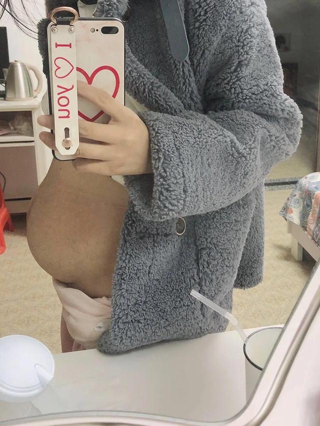 剖腹产一定需要收腹带？说说我的感受