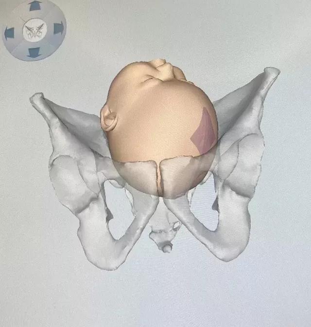 分娩导航来帮忙，顺产不慌张！