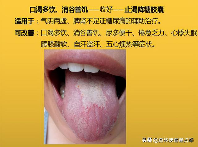 咽炎、高脂血症，四肢麻木，10个中成药，年过35岁后要收藏备好