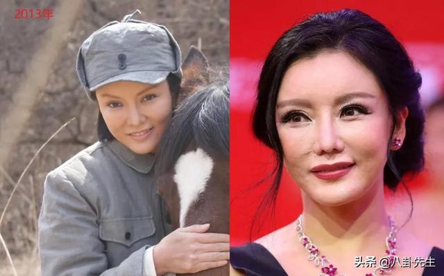 大陶红:折腾脸后颜值大跌的8位女星：多数已过气，有人嘴都歪了