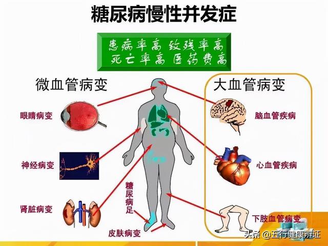 肺有火口渴，胃有火总饿，下焦火尿多！糖尿病的3把火要如何灭？