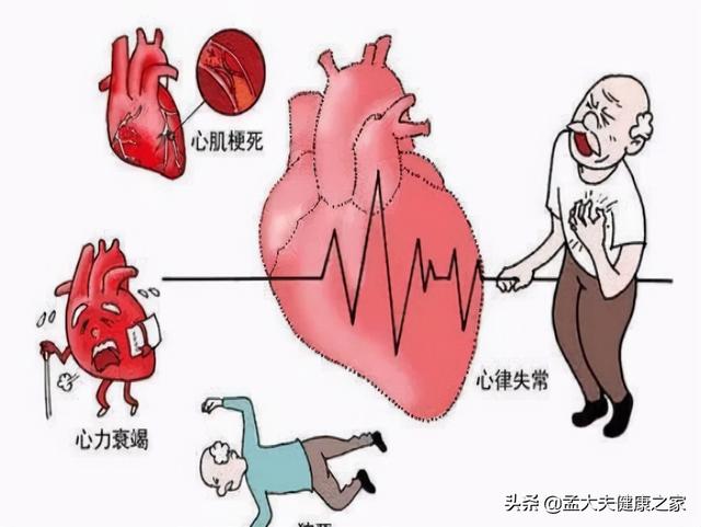 冠心病、心绞痛根在血脉不通，2个成药理气活血化瘀，保护心血管