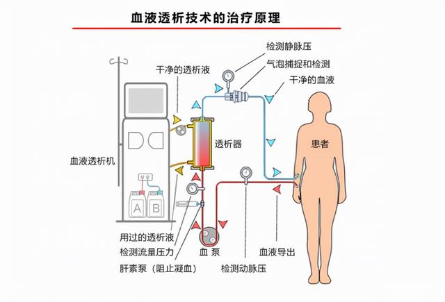 血液净化龙头山外山将上市，外资占八成市场，创始人或拥6亿身家