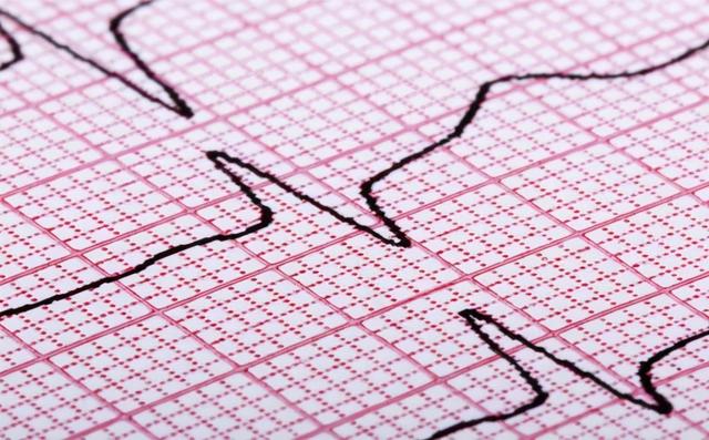 得了冠心病怎么调理好 四大原则要遵守