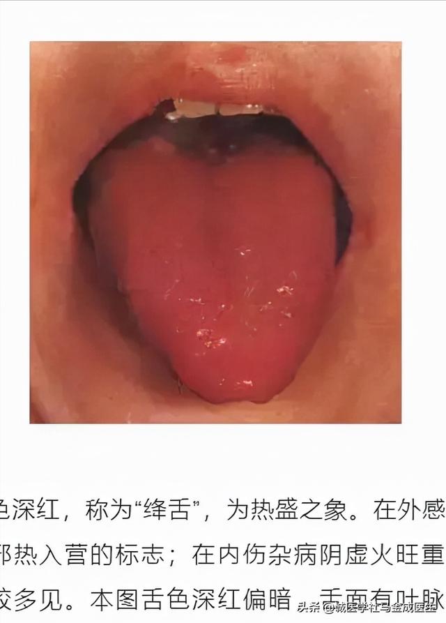 六种不同常见体质，看你属于哪种，看哪种方法适合你