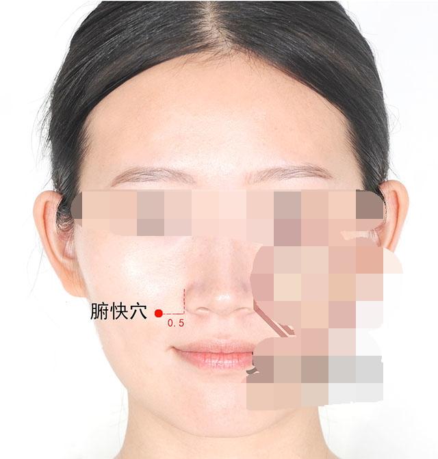 中医针灸鼻腔疾病处方1