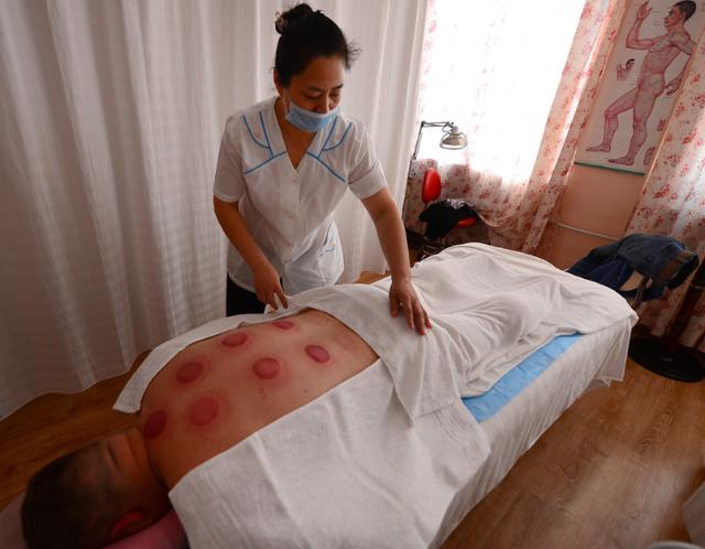 拔火罐时，后背出现的瘀血，是排出的毒素吗？看完涨知识了