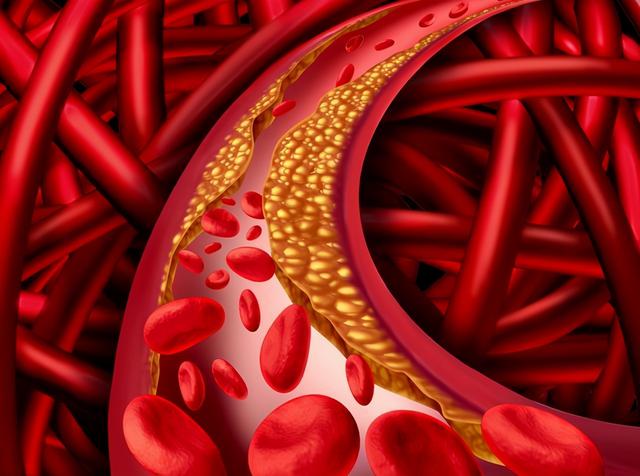 颠覆常识？南京大学研究发现：高盐饮食可以抑制癌细胞生长？
