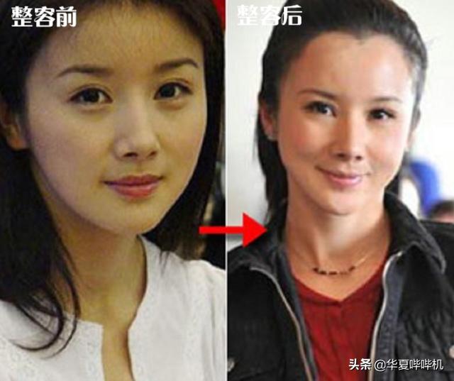 侣皓喆:明星大型“翻车”现场，她们是如何整容变毁容的
