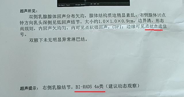 乳腺結節需要穿刺嗎？