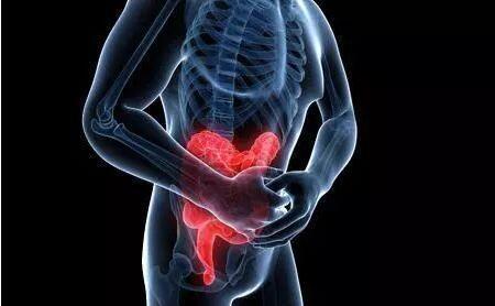 溃疡性结肠炎患者日常生活中应注意哪些方面？