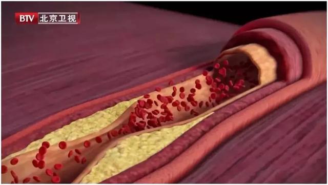 食物加醋or不加醋，差别到底有多大？那些被附加的“健康标签”究竟是真是假？