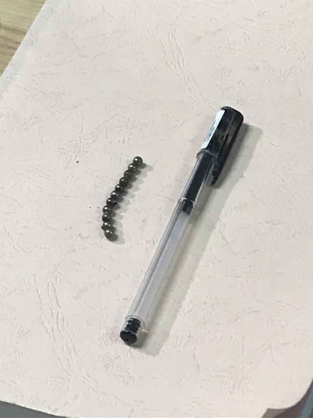 别给孩子玩磁力珠！3岁男童误吞11颗磁力珠 致4处肠穿孔