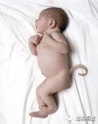 明查｜接种新冠疫苗后孕妇会生下长尾巴的畸形婴儿？