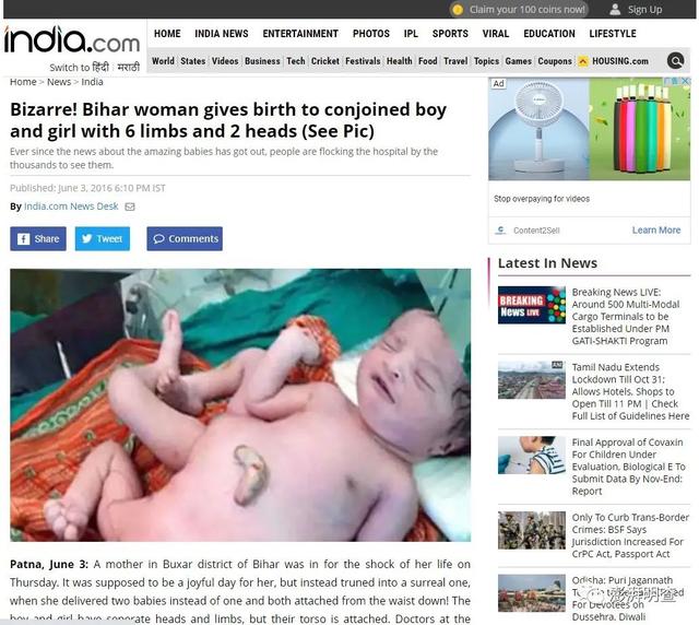 明查｜接种新冠疫苗后孕妇会生下长尾巴的畸形婴儿？