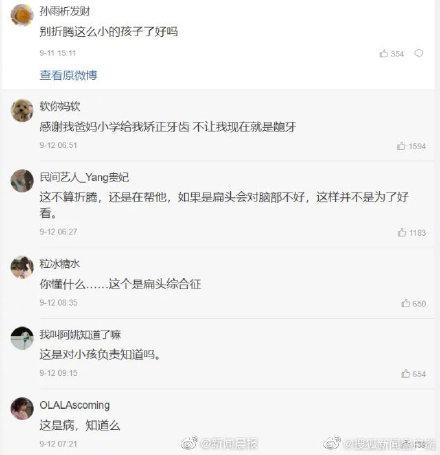 宝妈不顾家人反对给宝宝戴石膏矫正头型 你怎么看？