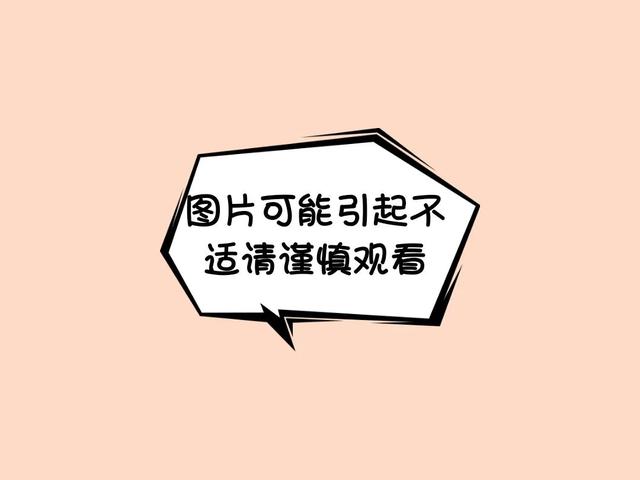 二胎妈妈突发胎盘早剥，多学科展开生死营救