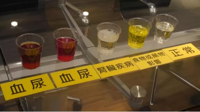 肾好不好一泡尿就能知晓？尿液常有几种变化，需给肾做检查