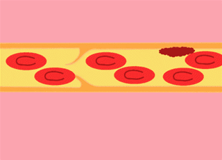 血脂高就不能吃蛋和肉？记好这四点，教你有效控血脂