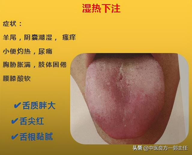 12种“热”藏于体内，反应的舌象、症状各不相同，自查便知