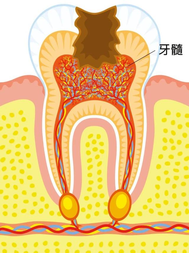 生命滙马泷齿科｜乳牙蛀牙需要及时补吗？