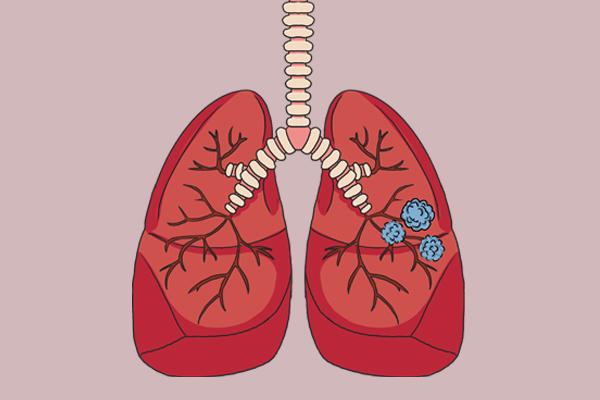 猪牛羊是结节的发物？不宜吃的是以下3种，结节患者应了解一下
