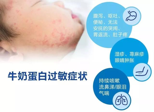 宝宝腹泻、体重不增，长湿疹是不是牛奶过敏？医生这么说的