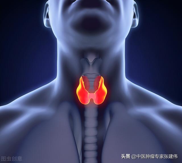哪種甲狀腺結節最可怕？4個方法判斷結節的良惡性