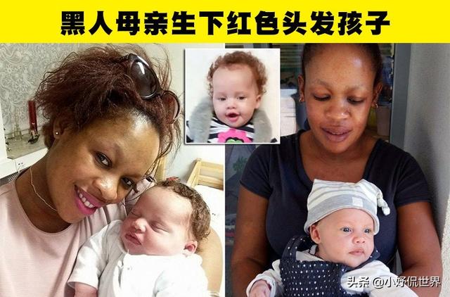 导致孩子出生后拥有与父母惊人差异的5种情况和科学解释