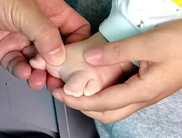 “30岁怀孕，孕6个月时发现宝宝脚有问题。”妈妈说着说着就哭了