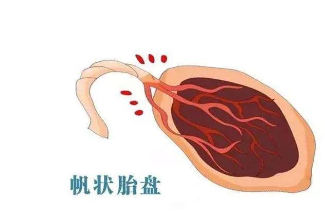 胎儿的生命之源——产科医生眼中的胎盘