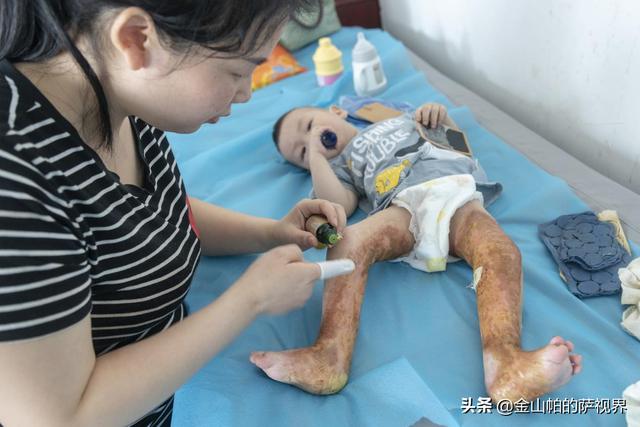 湖北咸宁：“咣当”一声学步车撞向茶几，一壶开水引发宝宝悲剧