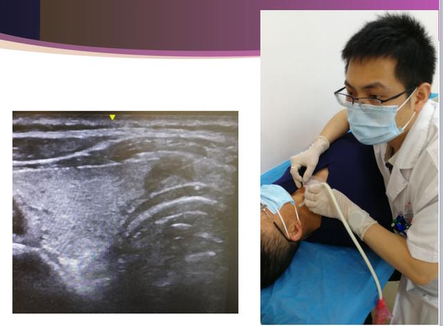 山东医专第一附属医院成功开展甲状腺细针穿刺活检术