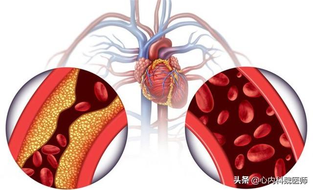 谷维素和维生素B12如何吃？医生详细解答，不妨来了解一下