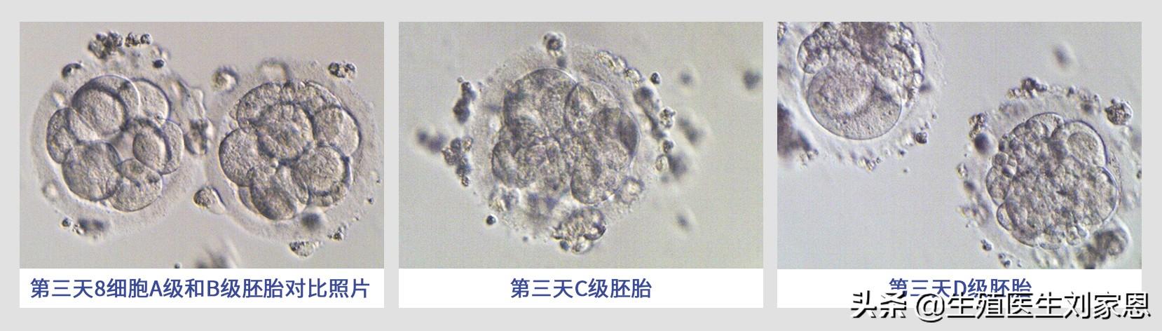 做试管婴儿移植囊胚成功率高吗？生殖医生写给试管助孕患者的话