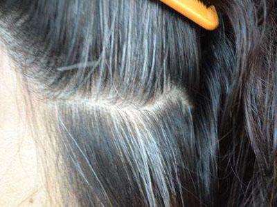 吃黑芝麻是养生还是伤身？带你看看关于黑芝麻，你需要知道的3点