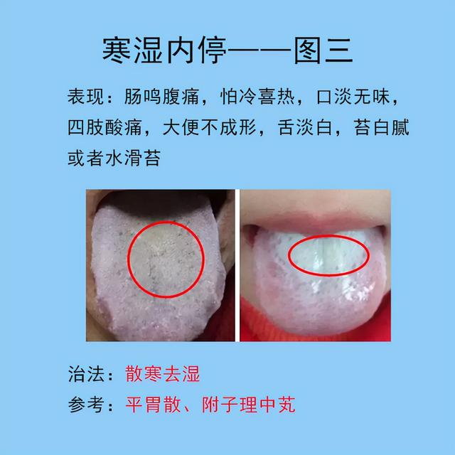 脾胃常见的10种舌象，以及临床表现，后面带解决方法
