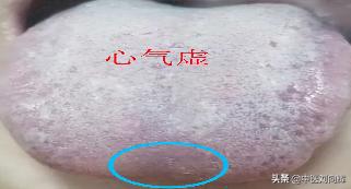 感觉气不足，一看就会，3分钟快速分辨哪个脏腑气虚