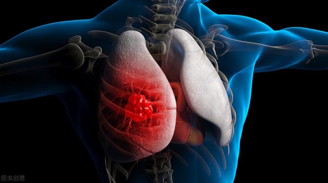 肿瘤的威胁「从头到脚」，连舌头都不会放过