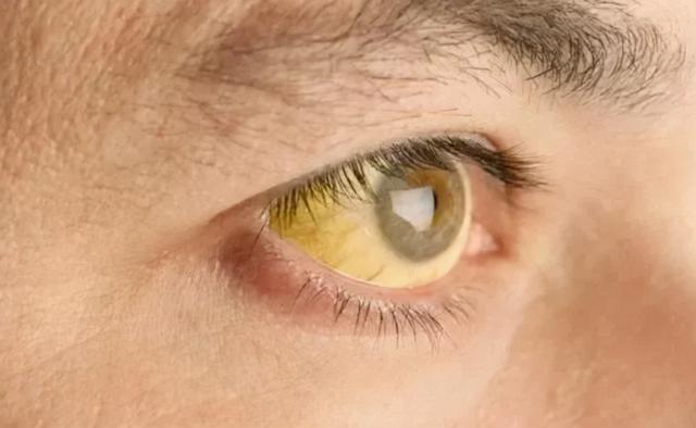 如果你有这5种症状，说明你该养肝了，常见三种中药教你养肝